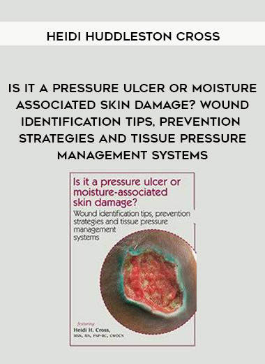 Is it a pressure ulcer or moisture-associated skin damage? Wound identification tips, prevention strategies and tissue pressure management systems – Heidi Huddleston Cross