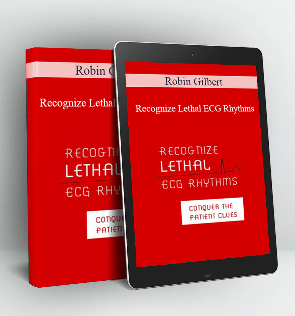 Recognize Lethal ECG Rhythms - Robin Gilbert